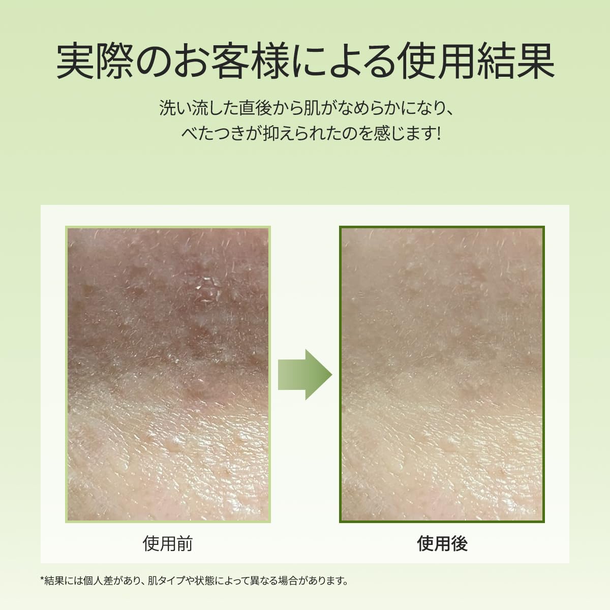 Arencia Premium Mochi Soap "Green" 120g / Coreia / Sabonete Facial / Hidratante / Esfoliante / Cuidado com os Poros