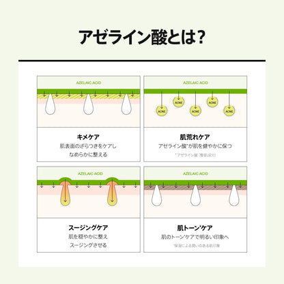 ANUA(アヌア)アゼライン酸15インテンスカーミングセラムマスクパック(7枚入り) フェイスマスク 油水分バランス 皮脂 毛穴ケア cica azelaic serum mask pack オゆらぎ肌 混合肌 オイリー肌 デイリー パック スキンケア【公式・正規品】