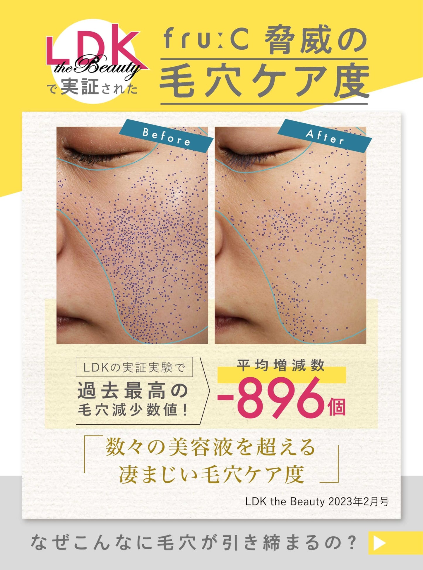 【Edição exclusiva Amazon】fru:C Sérum Facial Vitamina C 【Eleito o melhor para redução de poros da história pela LDK】Cápsulas White C para uma pele mais translúcida